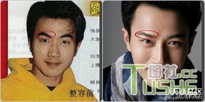 男星不为人知整容史 都很爱美啊