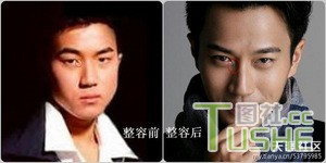 男星不为人知整容史 都很爱美啊