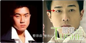 男星不为人知整容史 都很爱美啊