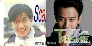 男星不为人知整容史 都很爱美啊