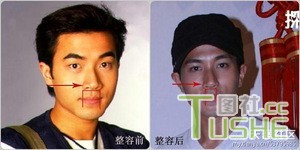 男星不为人知整容史 都很爱美啊