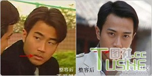 男星不为人知整容史 都很爱美啊