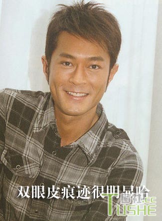 男星不为人知整容史 都很爱美啊