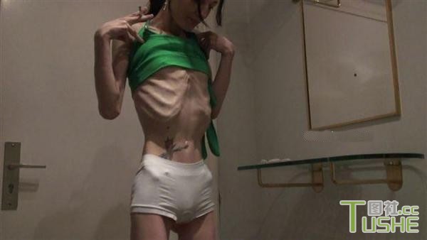 厌食症女孩的凄惨生活